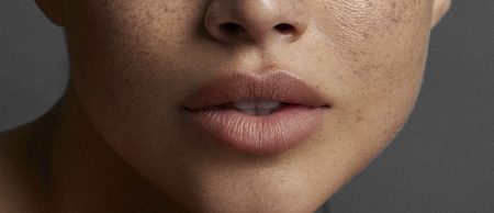 Cómo recuperar tus labios